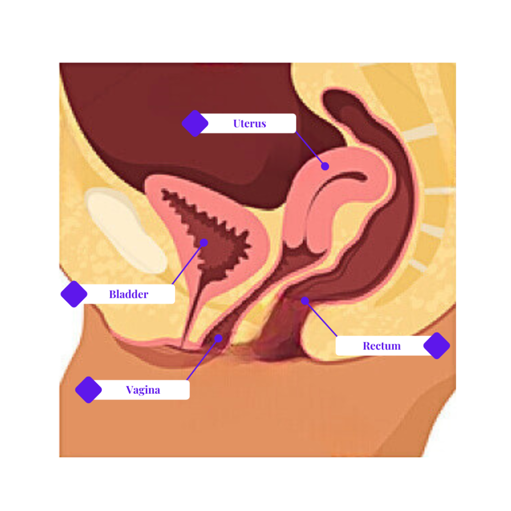 Retroflexed uterus