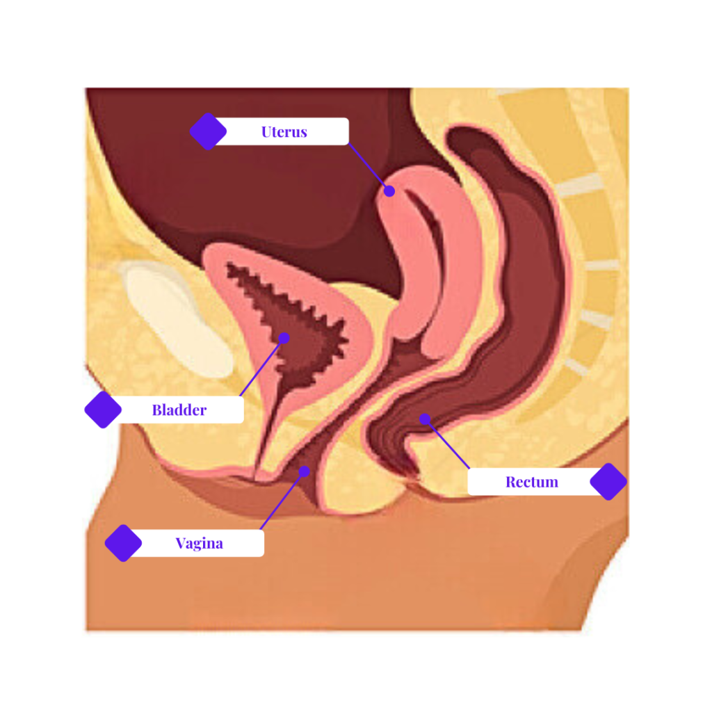 Retroverted uterus